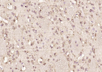 NUP160 Rabbit Polyclonal Antibody