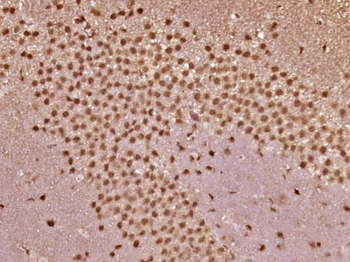 VHL Rabbit Polyclonal Antibody
