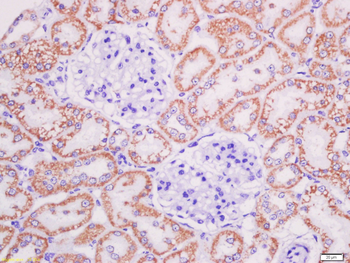 AGEs Rabbit Polyclonal Antibody