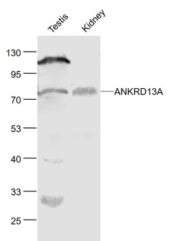 ANKRD13A antibody