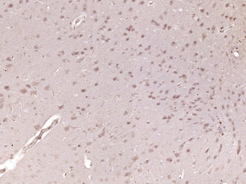 SMAD1 + SMAD5 Rabbit Polyclonal Antibody