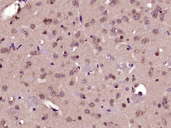 Bcl2L2 Rabbit Polyclonal Antibody