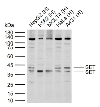 SET Rabbit Polyclonal Antibody