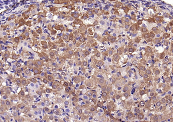 NBL1 Rabbit Polyclonal Antibody
