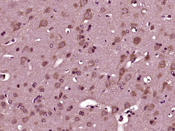 SEZ6L Rabbit Polyclonal Antibody