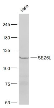 SEZ6L Rabbit Polyclonal Antibody