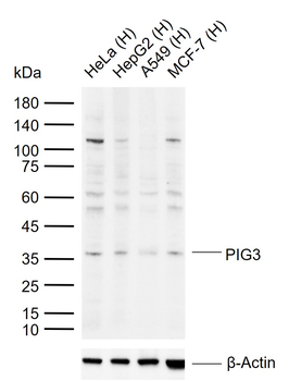 PIG3 Rabbit Polyclonal Antibody