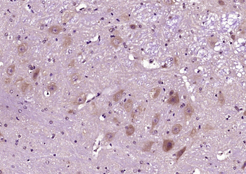 SEMA6D Rabbit Polyclonal Antibody