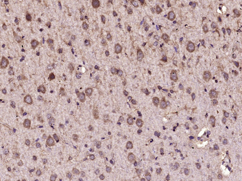 CAMKK2 Rabbit Polyclonal Antibody