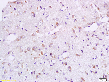 BCAT1 Rabbit Polyclonal Antibody
