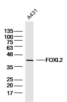 FOXL2 Rabbit Polyclonal Antibody