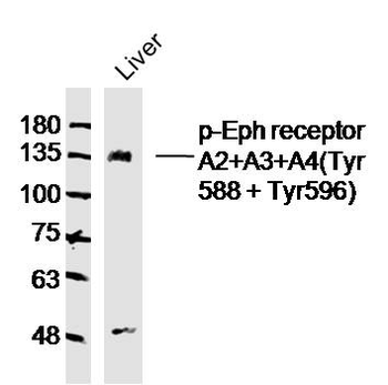 Phospho-Eph receptor A2+A3+A4 (Tyr588 + Tyr596) Rabbit Polyclonal Antibody