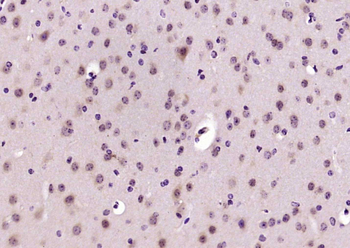 CARD7/NALP1 Rabbit Polyclonal Antibody