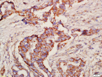 NALP12 Rabbit Polyclonal Antibody