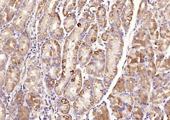 TSSC3 Rabbit Polyclonal Antibody