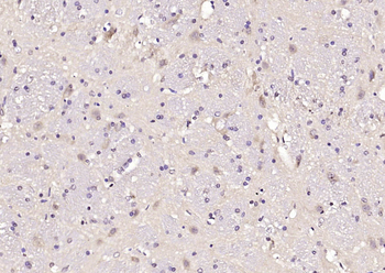 FLII Rabbit Polyclonal Antibody