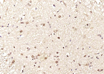 MOBKL2B Rabbit Polyclonal Antibody