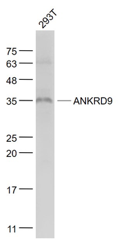 ANKRD9 Rabbit Polyclonal Antibody