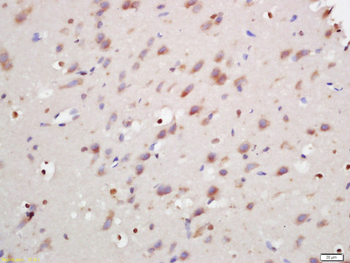 ANKRD9 Rabbit Polyclonal Antibody