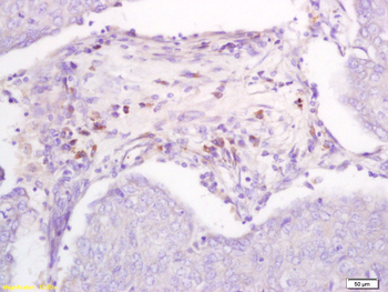 DBC2 Rabbit Polyclonal Antibody