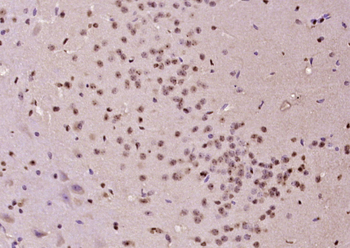 PCGF1 Rabbit Polyclonal Antibody