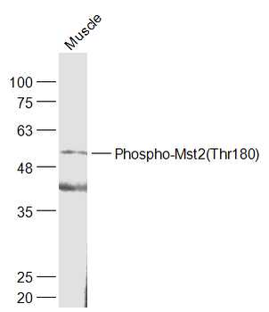 Phospho-Mst2 (Thr180) Rabbit Polyclonal Antibody