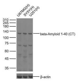Beta Amyloid 1-42 Rabbit Polyclonal Antibody