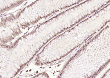 GASC1/KDM4C Rabbit Polyclonal Antibody