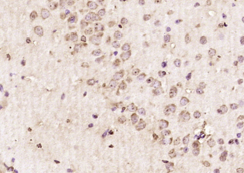 ABI2 Rabbit Polyclonal Antibody