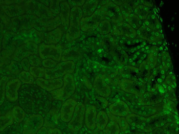 BCSC1 Rabbit Polyclonal Antibody