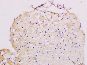 AT2R Rabbit Polyclonal Antibody