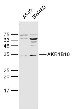 AKR1B10 Rabbit Polyclonal Antibody