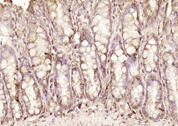 NOL8 Rabbit Polyclonal Antibody