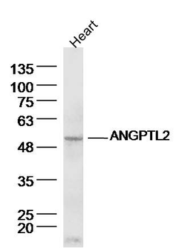 ANGPTL2 Rabbit Polyclonal Antibody