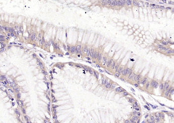 HRH2 Rabbit Polyclonal Antibody