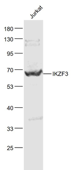 IKZF3 Rabbit Polyclonal Antibody