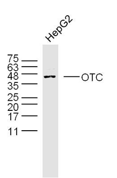 OTC Rabbit Polyclonal Antibody