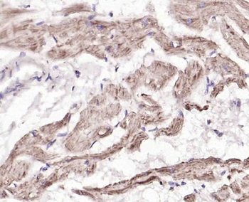 Phospho-PLB (Ser16) Rabbit Polyclonal Antibody
