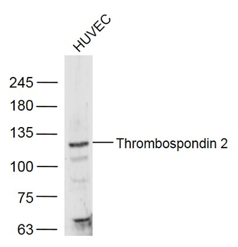Thrombospondin 2 Rabbit Polyclonal Antibody