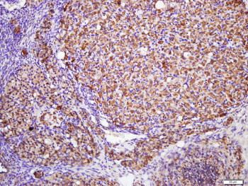 ALOX15B Rabbit Polyclonal Antibody