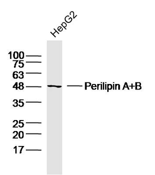 Perilipin A+B Rabbit Polyclonal Antibody