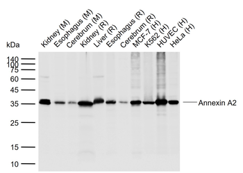 Annexin A2 Rabbit Polyclonal Antibody