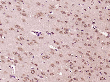 Phospho-EPH A3+A4+A5 (Tyr779) Rabbit Polyclonal Antibody