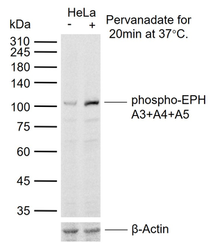 Phospho-EPH A3+A4+A5 (Tyr779) Rabbit Polyclonal Antibody