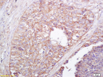 NALP4 Rabbit Polyclonal Antibody