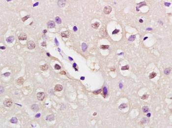 NUP50 Rabbit Polyclonal Antibody