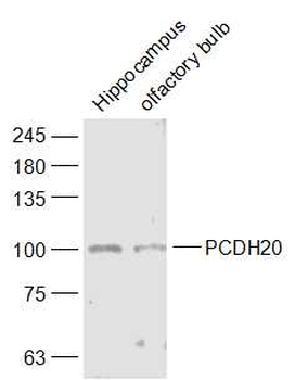 PCDH20 Rabbit Polyclonal Antibody
