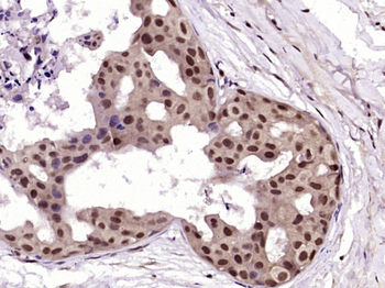 RAB35 Rabbit Polyclonal Antibody