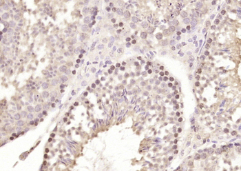 CDC45L Rabbit Polyclonal Antibody