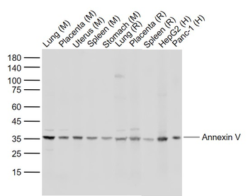 Annexin V Rabbit Polyclonal Antibody